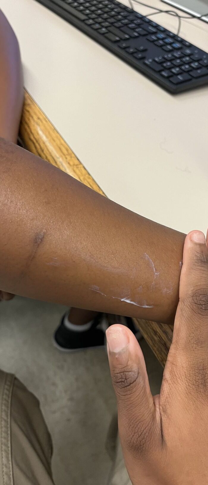 Why sunscreen is so important in preventing skin diseases